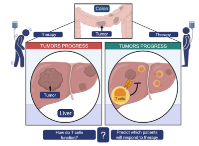 Liver metastasis: Improving chemotherapy outcomes and relapse