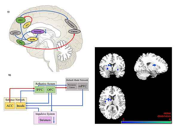 Effects of 18 mg nalmefene on resting-state functional connectivity.