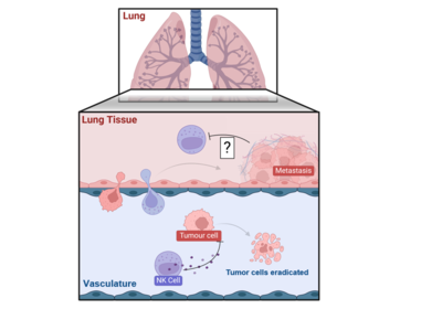 Lung metastasis: Unlocking NK cell potential in immunotherapy
