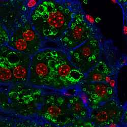 Liver tissue sections under high fat diet labeled with nuclei (red), lipid droplets (green) and cell borders (blue). Courtesy of Helmholtz Munich