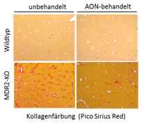 Aussichtsreiche Zielstruktur für die Behandlung biliärer Leberschädigung